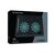 Conceptronic CNBCOOLPAD2F Black 15.6in 2-Fan Cooling Pad